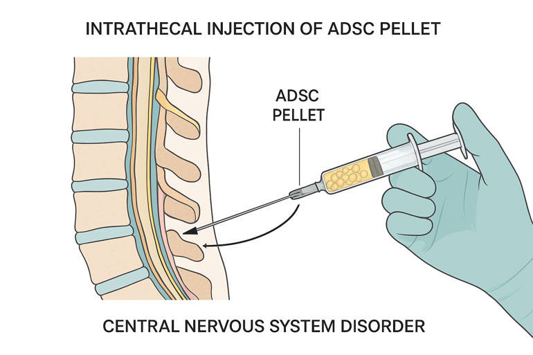 脳脊髄のイメージ