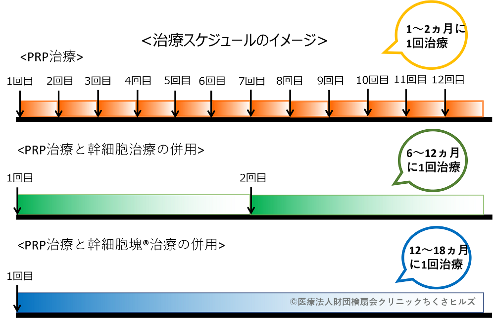 治療スケジュールのイメージ